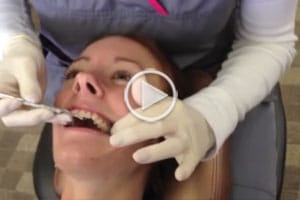 First Adjustment Video Cover at Hannah Orthodontics in Olathe Emporia Lenexa/Shawnee Louisburg Kansas City